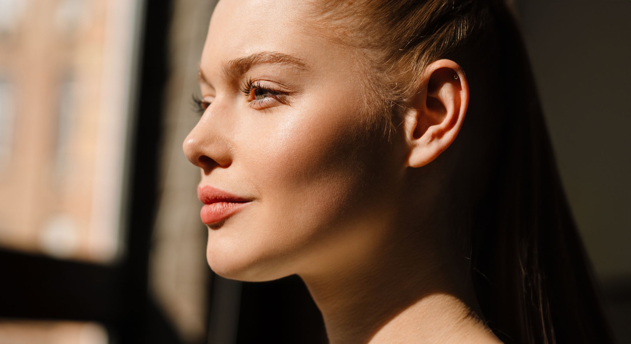 Mission Viejo melasma treatment model in natural light.